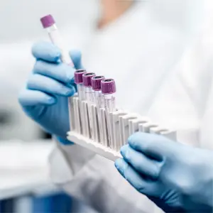 Alfafetoproteína en suero