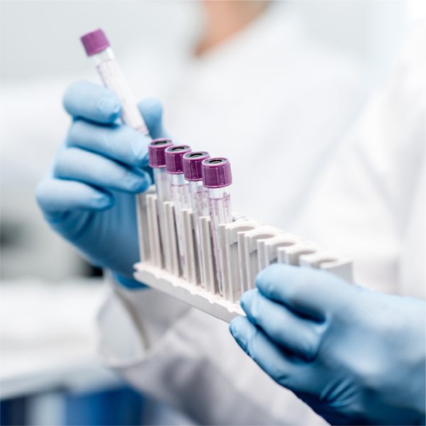 Alfafetoproteína en suero