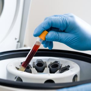 Amilasa en sangre en CHRISTUS MUGUERZA Hospital Alta Especialidad