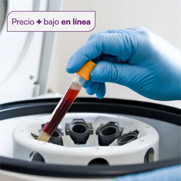 Antígeno de superficie de Hepatitis B