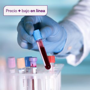 25 hidroxivitamina D