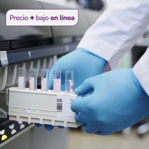 Anticuerpos anti hepatitis C