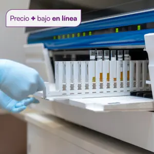 Examen general de orina CHRISTUS MUGUERZA