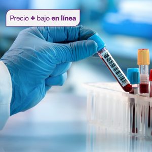 Glucosa (curva de tolerancia 2 horas)