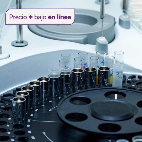 Glucosa en sangre CHRISTUS MUGUERZA