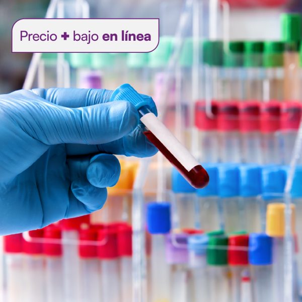 Hemoglobina glicosilada CHRISTUS MUGUERZA