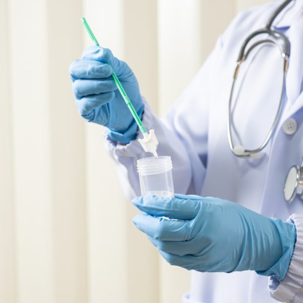 Papanicolaou (Citología vaginal en base líquida )