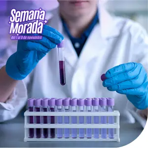 25 hidroxivitamina D