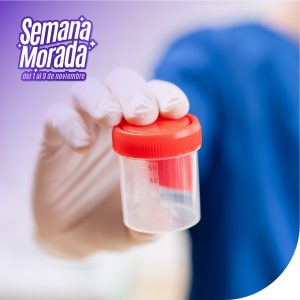 Velocidad de sedimentación globular (VSG)