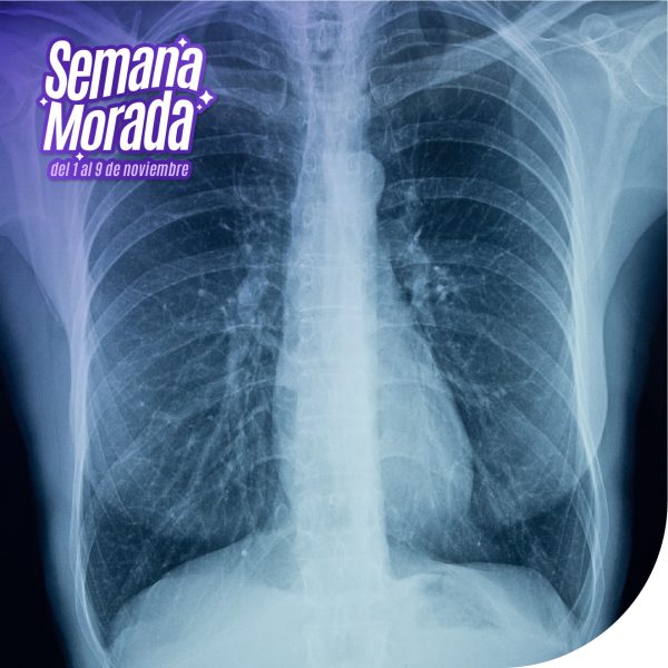 Rayos X abdomen o vientre 1 posición