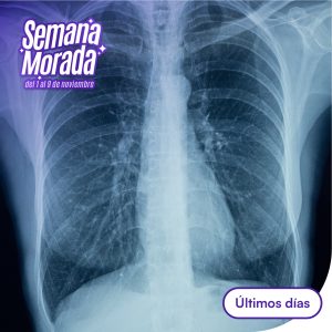 Rayos X senos paranasales 1 posición