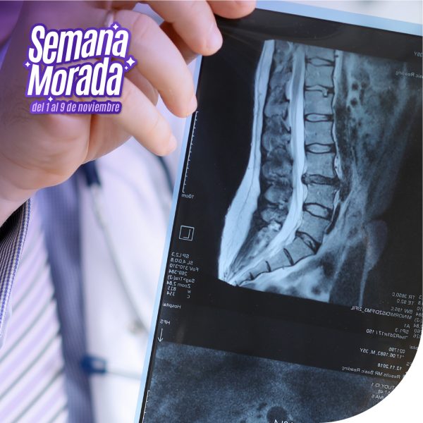 Rayos X abdomen o vientre 2 posiciones