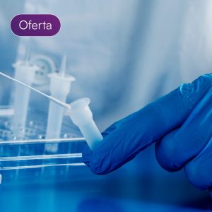 Prueba de antígeno SARS CoV-2 (COVID-19)