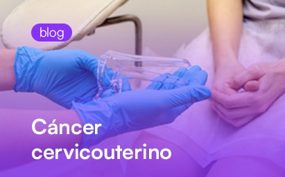 Blog Cáncer cervicouterino