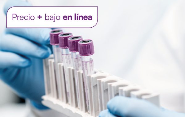 Antígeno prostático específico libre (PSA libre)